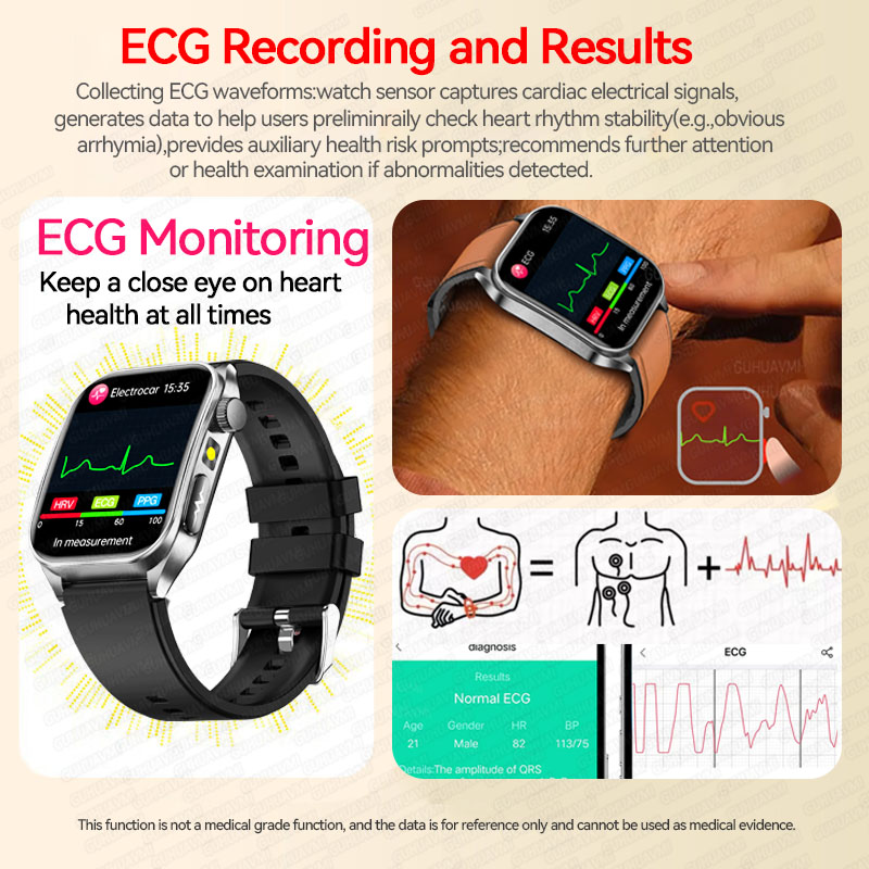 Nuovo Smartwatch 2026 con Trat - Industrial Laser Training recensione e prezzo